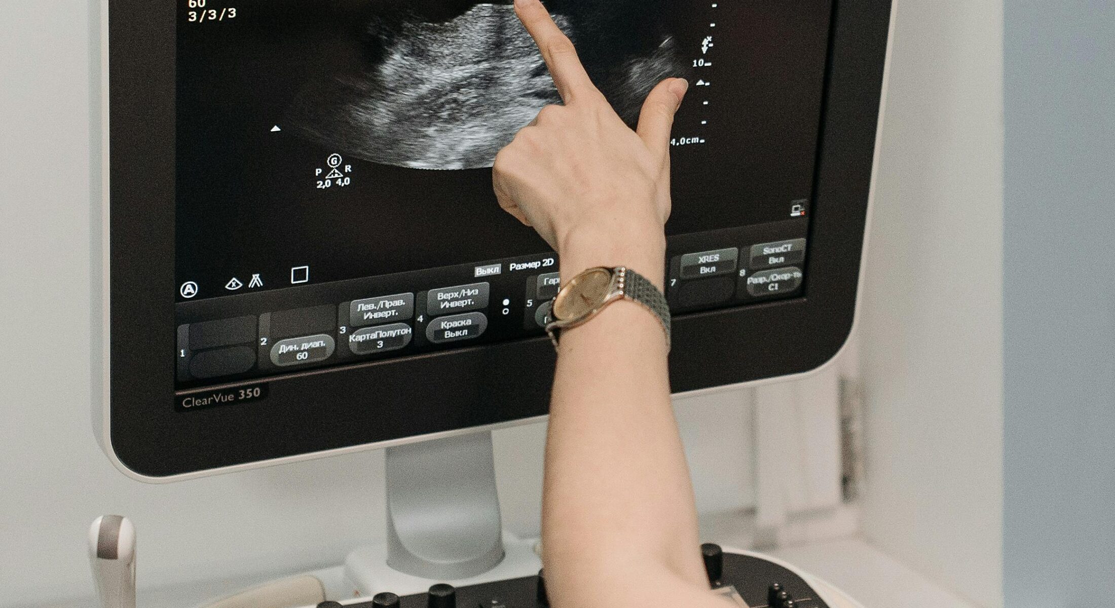 Healthcare professional demonstrating advanced ultrasound imaging on a modern diagnostic system at a medical technology exhibition.